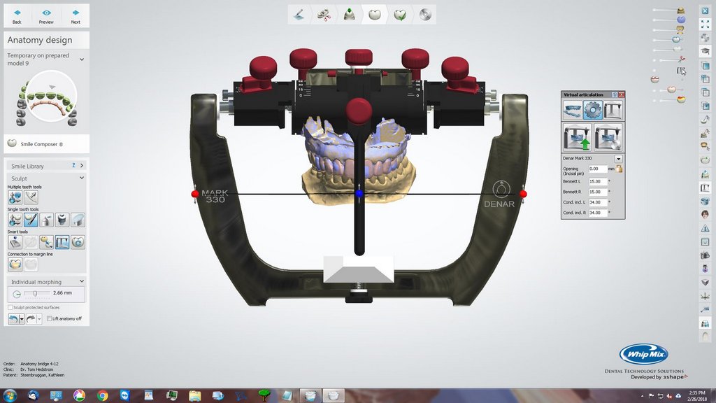 Functional Occlusion in the Dental Lab: Understanding the 3